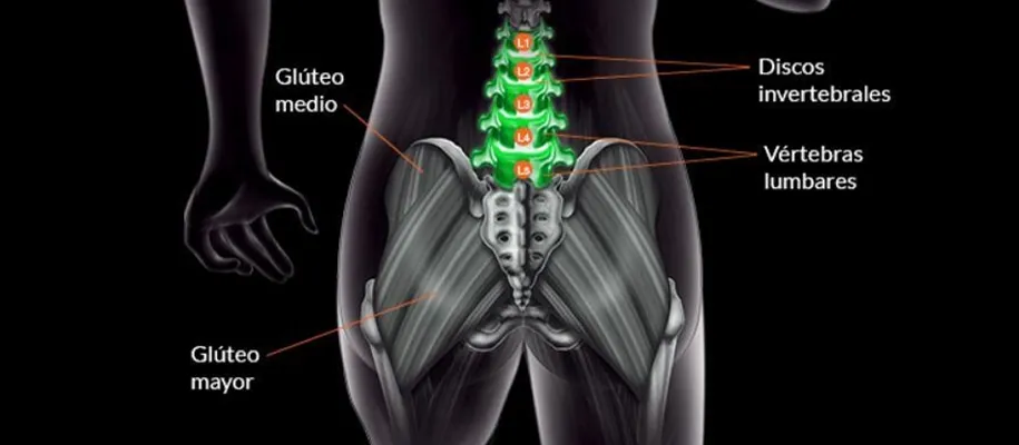Image of lumbar vertebrae and intervertebral discs