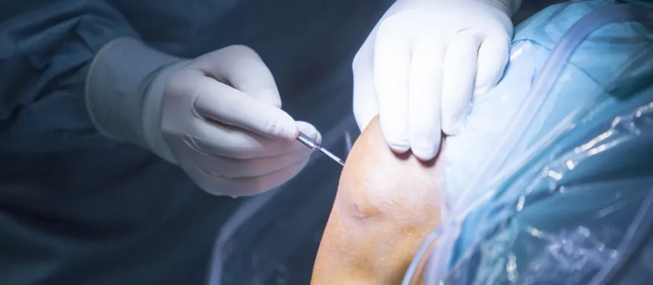 DR. Ricardo Monge explains knee arthroscopy procedure
